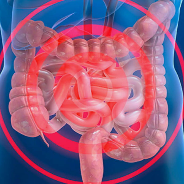 CEN-gammagrafia-de-sangrado-intestinal-en-ciudad-de-QUITO-600x600